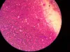 Cachorro com verme: o diagnóstico é feito por exame de sangue, que vai atestar se há a presença de microfilárias na corrente sanguínea.